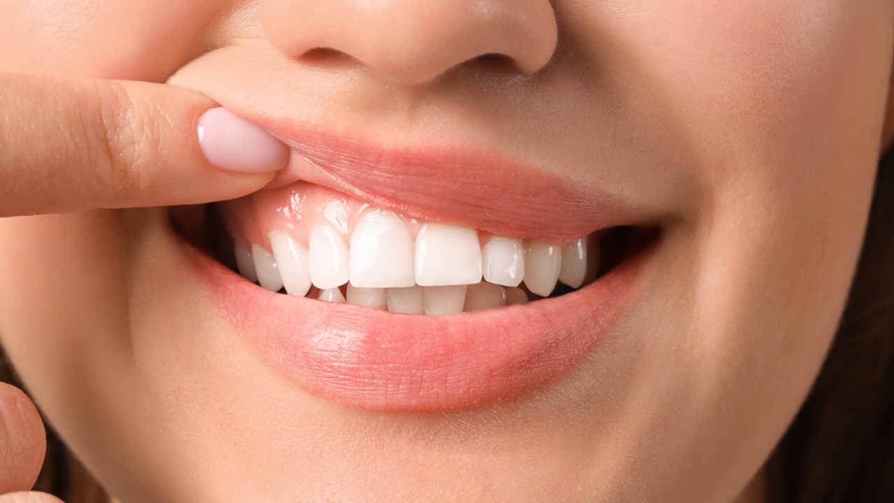 How OEM Teeth Whitening Strips Address Common Concerns of People